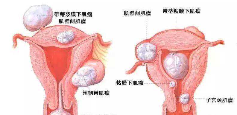 北京哪里有供卵试管生儿子的医院（北京做供精